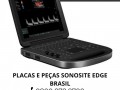 assistencia-tecnica-especializada-sonosite-small-2